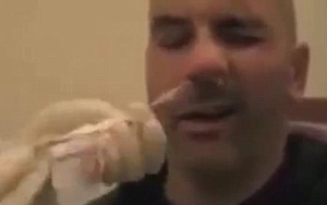 Bác sĩ phát hiện và gắp ra con "quái vật" dài hàng mét làm tổ trong mũi người đàn ông