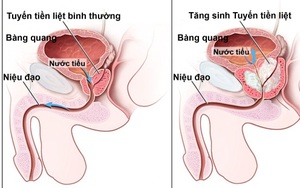 Đêm nào cũng có thói quen này, sáng dậy phải đi khám ngay