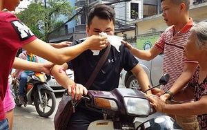 Nhập viện cấp cứu vì bị thanh sắt bất ngờ lao ra đập trúng mặt