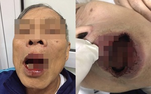Vụ tiến sỹ bị đánh khi đi tập thể dục: "Đây là sự việc hết sức nghiêm trọng"