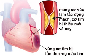 Dấu hiệu nhận biết căn bệnh gây tử vong trong vài giờ: Tất cả mọi người nên lưu ý