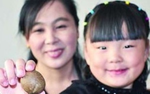 Phát hiện viên sỏi cực quý trong gan cừu