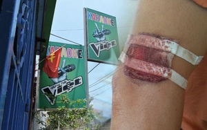 Nhân viên quán karaoke nói chuyện với khách bằng "nắm đấm"