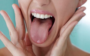 Lưỡi to: Cảnh báo căn bệnh có thể gây đột tử trong khi ngủ