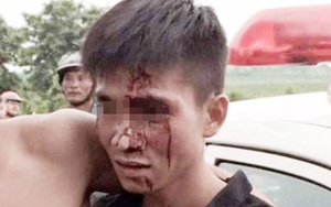 Tướng công an "giải vây" vụ thanh niên vi phạm giao thông, kích động dân quây cảnh sát