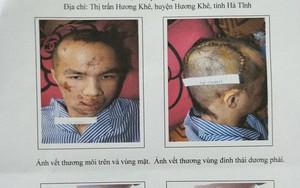 Bị chém vỡ đầu khi đi giải quyết mâu thuẫn giúp bạn