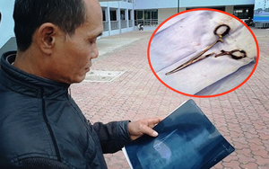 Bác sĩ Việt Nam bỏ quên kéo trong bụng bệnh nhân 18 năm khiến báo chí nước ngoài xôn xao