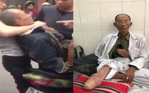 Khởi tố hai cha con hành hung thương binh do va chạm giao thông