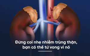 3 dấu hiệu cảnh báo nhiễm trùng thận: Nắm vững để không gặp hậu quả nặng nề