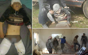 Bị bom dội đứt lìa 2 chân, em bé Syria hoảng loạn la hét đòi bố bế