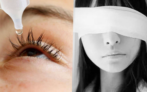 Tích cực tra thuốc nhỏ mắt cho con, ông bố không ngờ đã hại con gái rơi vào cảnh mù lòa