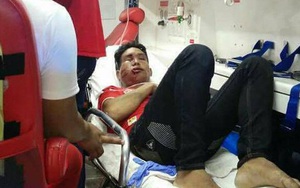 Hậu Myanmar vs Malaysia, fan đội khách bị CĐV chủ nhà đánh biến dạng mặt mũi