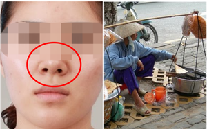 Những tướng xấu mang đến vận số khó khăn