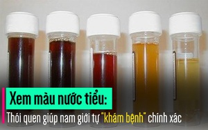 Xem màu nước tiểu: Cách tự “khám” ra bệnh quý ông nào cũng nên biết sớm