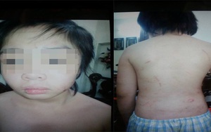 Hà Nội: Gia đình báo công an sau khi bé trai nói "trốn khỏi nhà bố đẻ và mẹ kế vì bị đánh"