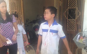 Học sinh lớp 7 bị bố của bạn đánh sưng mặt, công an viên đến nói "không liên quan"
