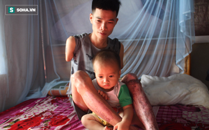 Cám cảnh ông bố 9x cụt 2 tay chăm con thơ dại, vợ lạnh lùng bỏ đi