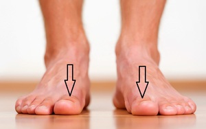 Một dấu hiệu ở ngón chân cái tiết lộ tình trạng "bất lực" ở nam giới