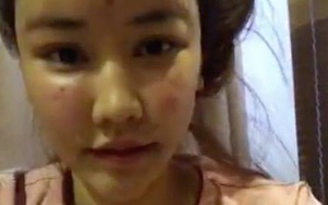 Những lần "dao kéo" cứu vớt tuổi thanh xuân của Maya