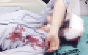 Hà Nội: Triệu tập 2 nghi can đánh nữ sinh lớp 10 gãy tay, vỡ đầu