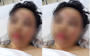 Nhân chứng vụ tạt axít: “Thấy axít cháy nham nhở gương mặt cô gái mà tôi thất kinh!”