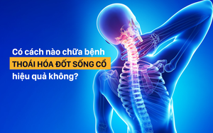 Giải pháp chữa bệnh thoái hóa đốt sống cổ: Kể cả khi chưa mắc bệnh cũng nên tham khảo sớm