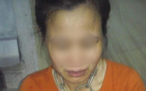Thái Bình: Chồng dùng nhục hình xích cổ vợ, bẻ gãy tay con phải nhập viện