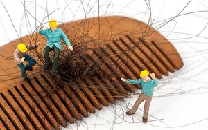 Rụng tóc nhiều bị bệnh gì?