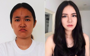 Câu chuyện bi thương đằng sau ca phẫu thuật thẩm mỹ xuất sắc của cô gái từng có bộ hàm như cá piranha