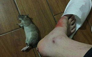Nhập viện cấp cứu vì chuột cắn