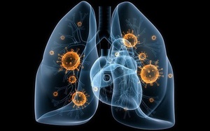 [Đọc nhanh] Cách loại bỏ độc tố ra khỏi phổi: Muốn ngừa ung thư, phải bắt đầu từ việc nhỏ