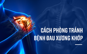 Xương khớp chắc khỏe quyết định tuổi thọ và chất lượng sống: BS khuyên bạn nên làm 3 việc