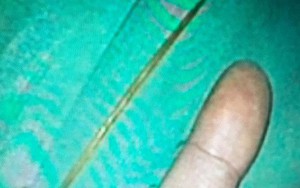 Suýt chết vì vừa ngậm tăm vừa uống nước