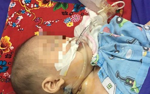 SOS: Hãy dừng ngay cho trẻ uống thuốc cam không rõ nguồn gốc