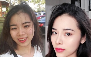 "Đập mặt làm lại" để bước qua quá khứ cay đắng, cô gái Cần Thơ thành hotgirl, đổi đời nhờ thẩm mỹ
