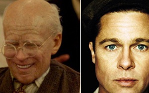 Huyền thoại "sống ngược tuổi" Benjamin Button và những câu chuyện về căn bệnh có thật