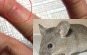 Cảnh báo từ chuyên gia: Đừng để mang bệnh vì không để ý vết chuột cắn