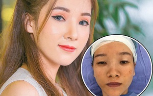 Cô gái "mắt lươn" lột xác 180 độ sau PTTM: Phải sống thật tốt để người từng chê mình thấy hối hận!