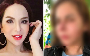 Lin Da - hotgirl chuyển giới 1 triệu followers bất ngờ chia sẻ ảnh mặt biến dạng sau khi nạo silicon