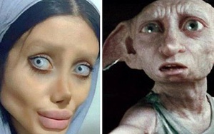 Cô gái phẫu thuật thẩm mỹ hơn 50 lần để nhìn giống Angelina Jolie, kết quả trả về gia tinh Dobby