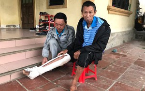 Con trai đánh bố gãy xương, bầm tím khắp người: "Nó còn mang xăng định đốt cả bố"