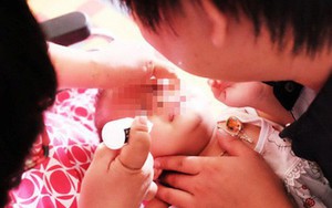 Bà vắt chanh vào mắt trị ghèn, bé trai 15 ngày tuổi bị loét giác mạc nghiêm trọng