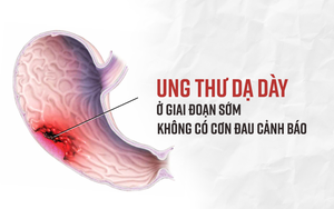 Phó giáo sư Mỹ chỉ rõ 6 dấu hiệu không gây đau nhưng cảnh báo sớm bệnh ung thư dạ dày