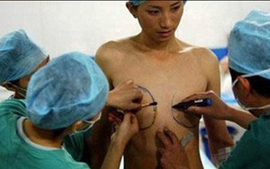 Chuyển giới - Tác động của phẫu thuật và hormon