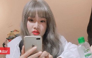 Sau hơn 1 năm đập mặt xây lại, 'Thị Nở tái sinh' nay đã trở thành một chủ cơ sở thẩm mỹ 'tiền vào như nước'