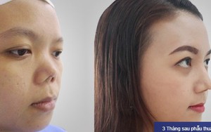 Lý giải của Bác sĩ Huy Kangnam: Sửa mũi gọt cằm có đổi vận?