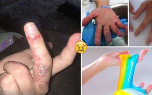 Cảnh giác với "chất nhờn ma quái"