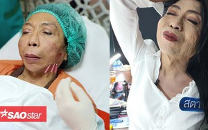 Sốc: 'Thục nữ hot nhất Thái Lan' đi tân trang da mặt nhưng cái kết vẫn cực thê thảm