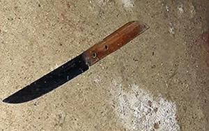 Nam sinh lớp 12 đâm dao vào mặt bạn gái khi bị chia tay