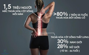 Thoái hóa cột sống là gì? Nguyên nhân, triệu chứng và cách chữa dứt điểm